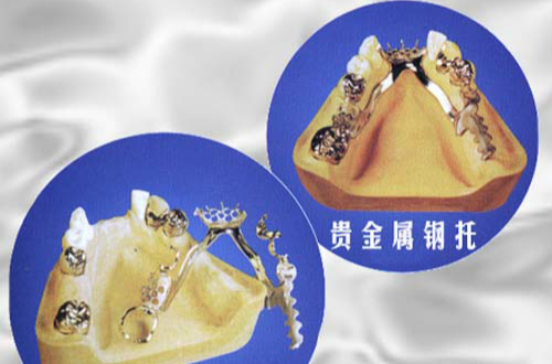 贵金属做对冲(贵金属做对冲什么意思)